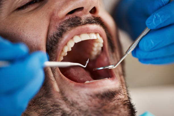 Best Emergency Dental Care for Broken or Chipped Teeth in Magnolia, NJ