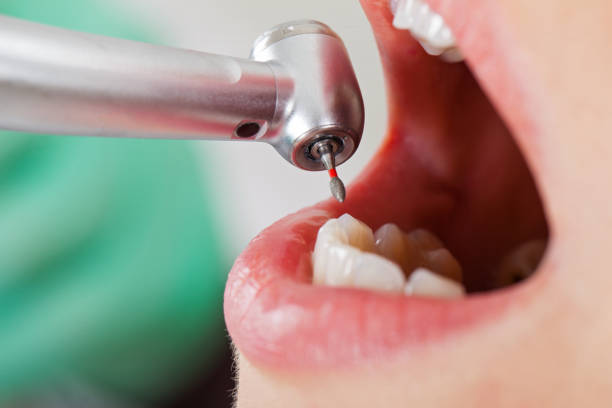 Best Emergency Dental Care for Broken or Chipped Teeth in Magnolia, NJ